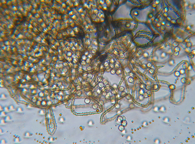 Arcyria (pomiformis ?)